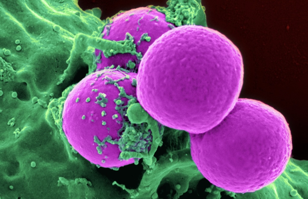 MIT สร้างปัญญาประดิษฐ์ออกแบบยา ได้ยาปฏิชีวนะตัวใหม่สู้แบคทีเรียดื้อยา